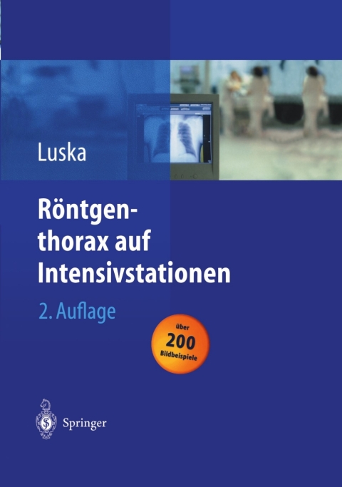 Cover image for book Röntgenthorax auf Intensivstationen