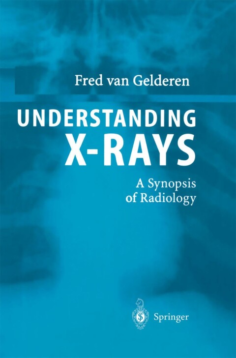 Cover image for book Understanding X-Rays