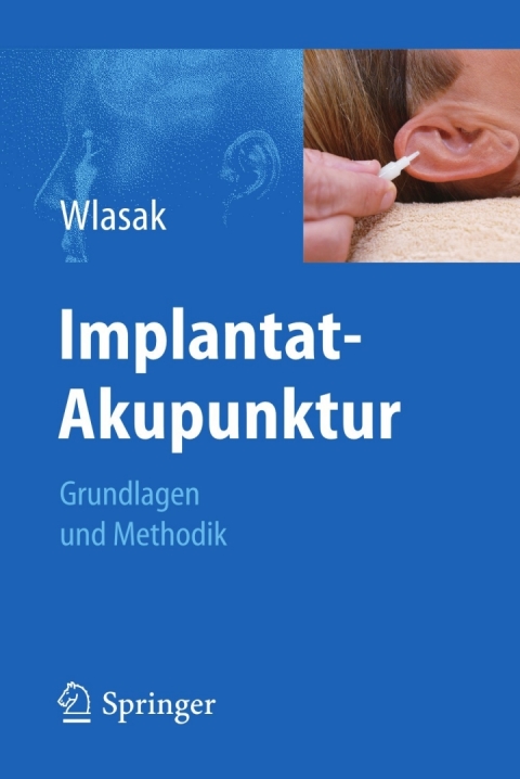 Cover image for book Implantat-Akupunktur