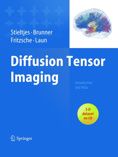Cover image for book Diffusion Tensor Imaging