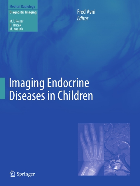 Cover image for book Imaging Endocrine Diseases in Children