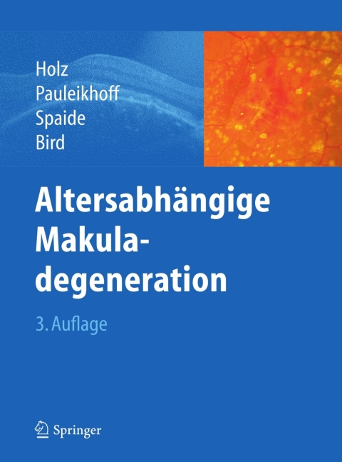 Cover image for book Altersabhängige Makuladegeneration