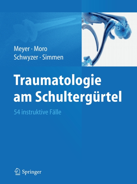 Traumatologie am SchultergÃ¼rtel 