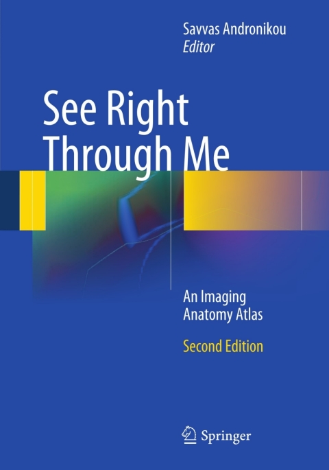 Cover image for book See Right Through Me