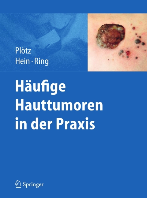 Cover image for book Häufige Hauttumoren in der Praxis