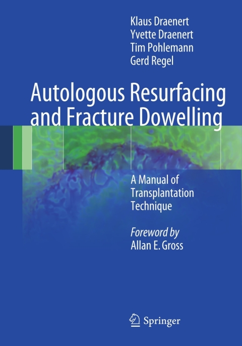 Cover image for book Autologous Resurfacing and Fracture Dowelling