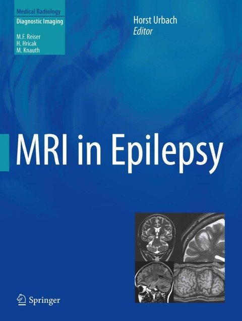 Cover image for book MRI in Epilepsy