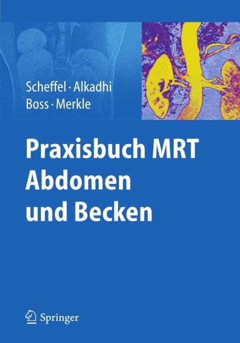Cover image for book Praxisbuch MRT Abdomen und Becken