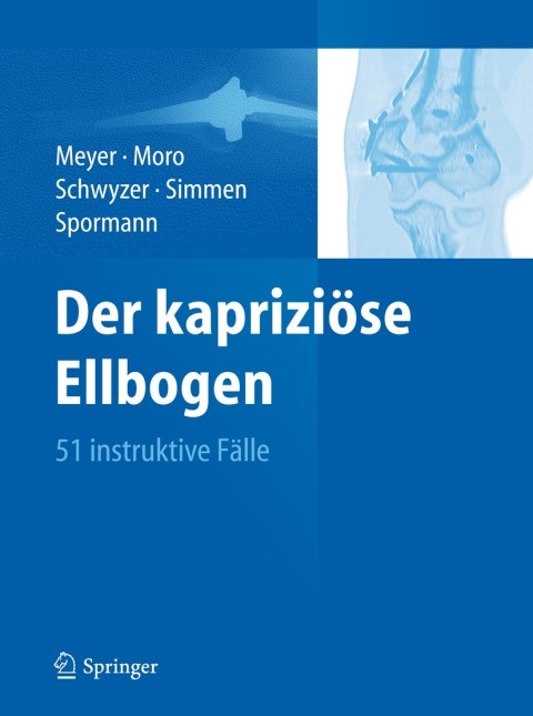 Cover image for book Der kapriziöse Ellbogen