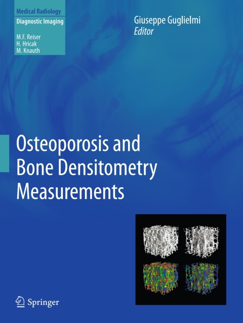 Cover image for book Osteoporosis and Bone Densitometry Measurements