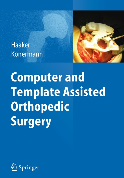 Cover image for book Computer and Template Assisted Orthopedic Surgery