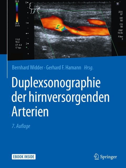 Cover image for book Duplexsonographie der hirnversorgenden Arterien