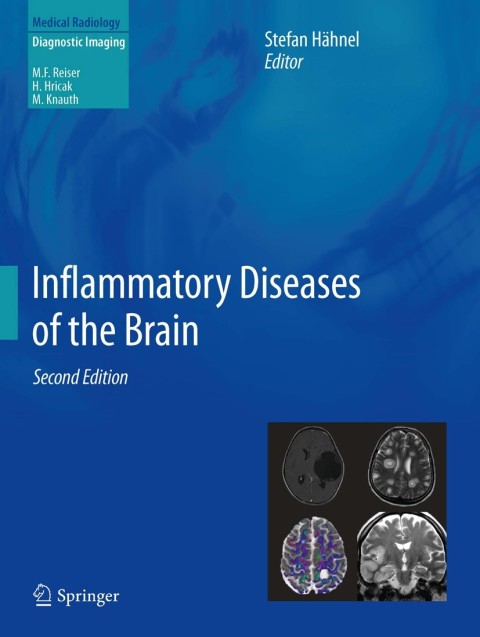 Cover image for book Inflammatory Diseases of the Brain