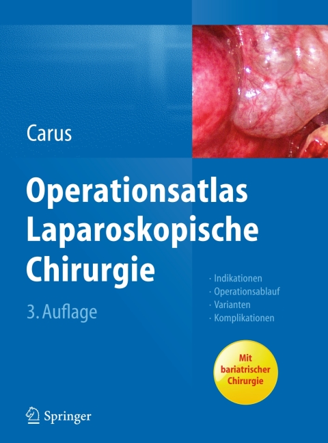 Cover image for book Operationsatlas Laparoskopische Chirurgie