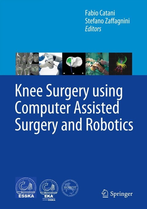 Cover image for book Knee Surgery using Computer Assisted Surgery and Robotics