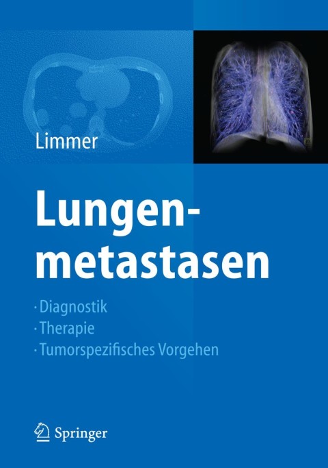 Cover image for book Lungenmetastasen