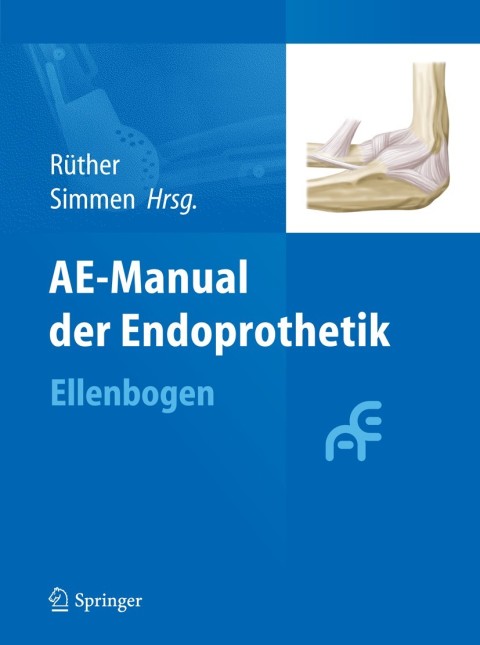 Cover image for book AE-Manual der Endoprothetik