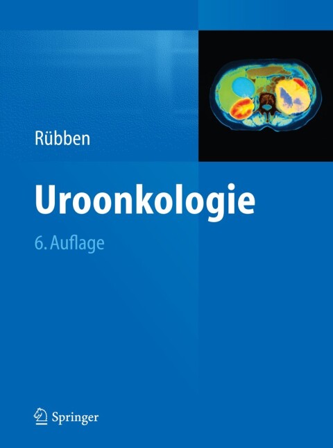 Cover image for book Uroonkologie