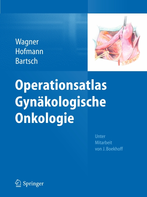 Cover image for book Operationsatlas Gynäkologische Onkologie