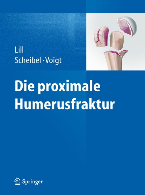 Cover image for book Die proximale Humerusfraktur