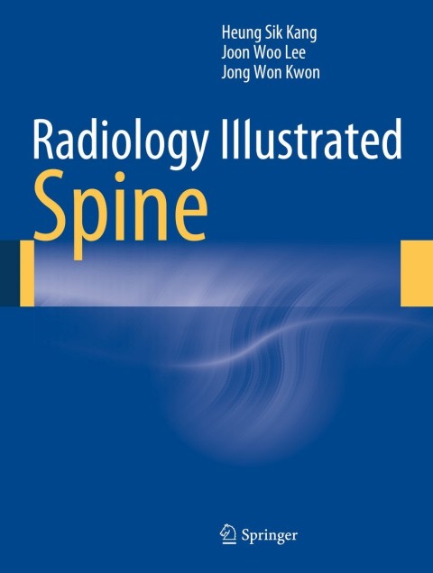 Cover image for book Radiology Illustrated: Spine