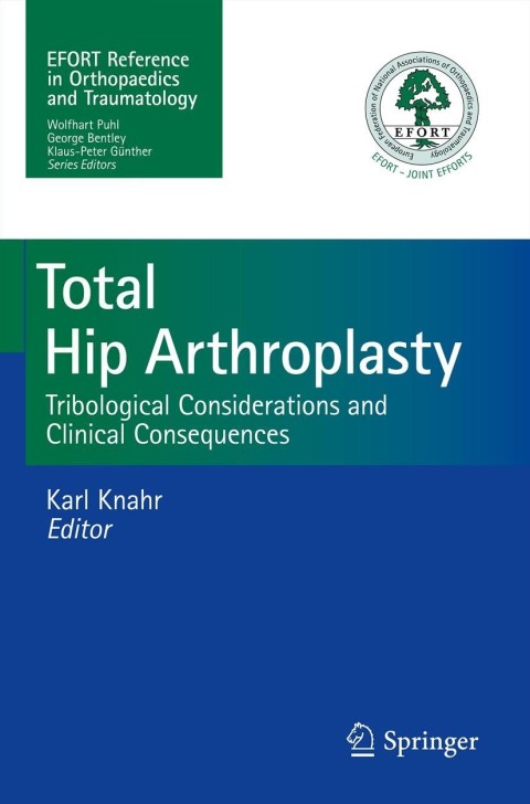 Cover image for book Total Hip Arthroplasty