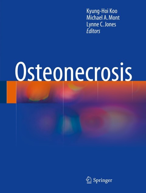 Cover image for book Osteonecrosis