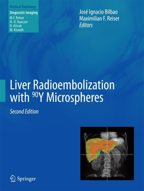 Cover image for book Liver Radioembolization with 90Y Microspheres
