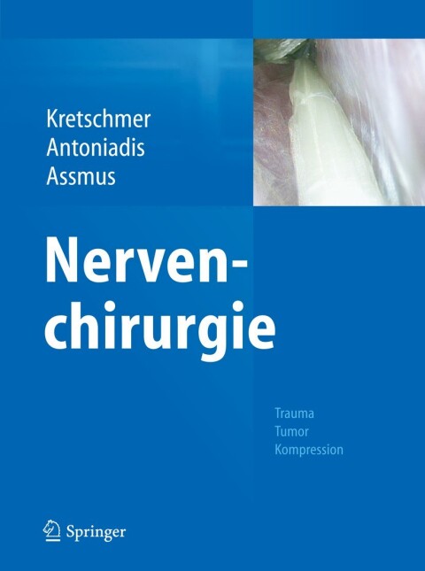 Cover image for book Nervenchirurgie