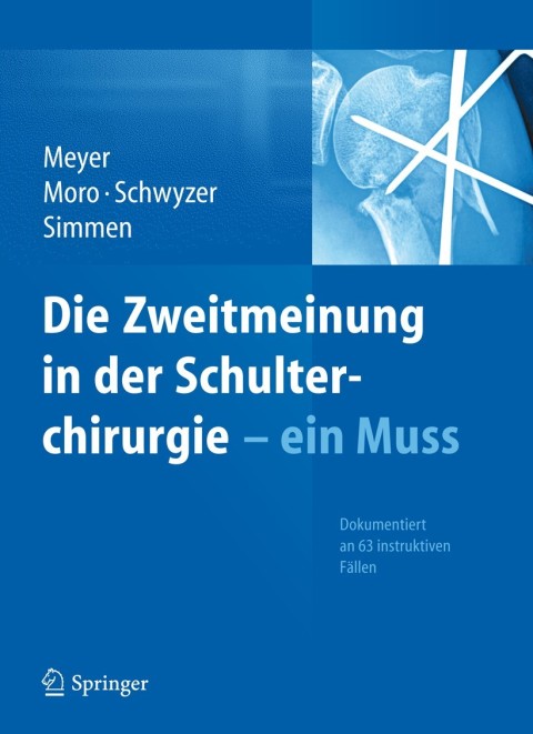 Cover image for book Die Zweitmeinung in der Schulterchirurgie - ein Muss