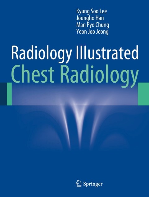 Cover image for book Radiology Illustrated: Chest Radiology