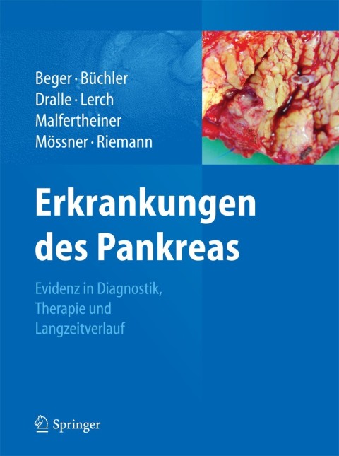 Cover image for book Erkrankungen des Pankreas