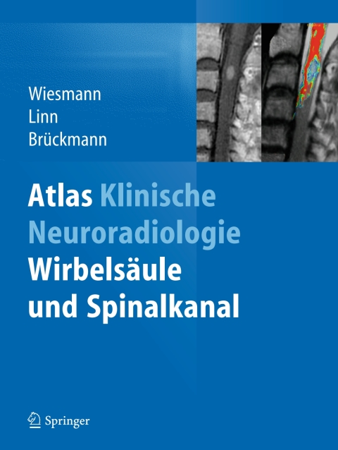Cover image for book Atlas Klinische Neuroradiologie