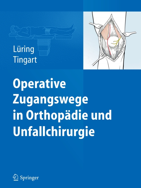 Cover image for book Operative Zugangswege in Orthopädie und Unfallchirurgie