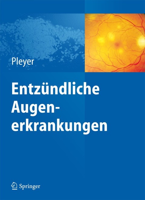 Cover image for book Entzündliche Augenerkrankungen