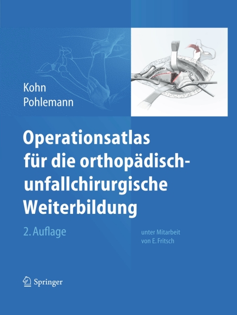 Cover image for book Operationsatlas für die orthopädisch-unfallchirurgische Weiterbildung