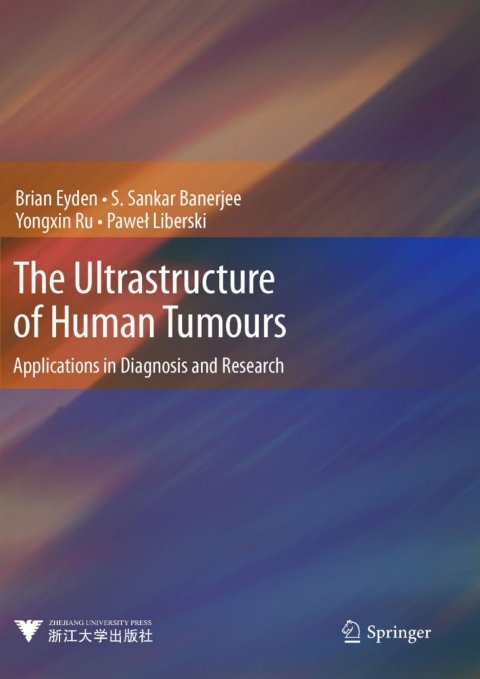 Cover image for book The Ultrastructure of Human Tumours