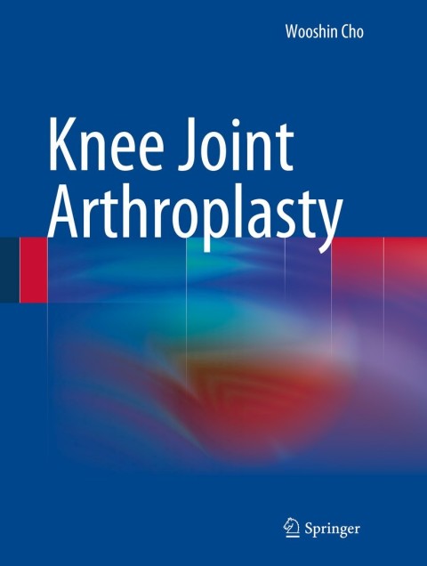 Cover image for book Knee Joint Arthroplasty