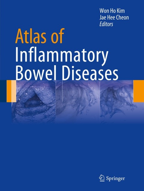 Cover image for book Atlas of Inflammatory Bowel Diseases