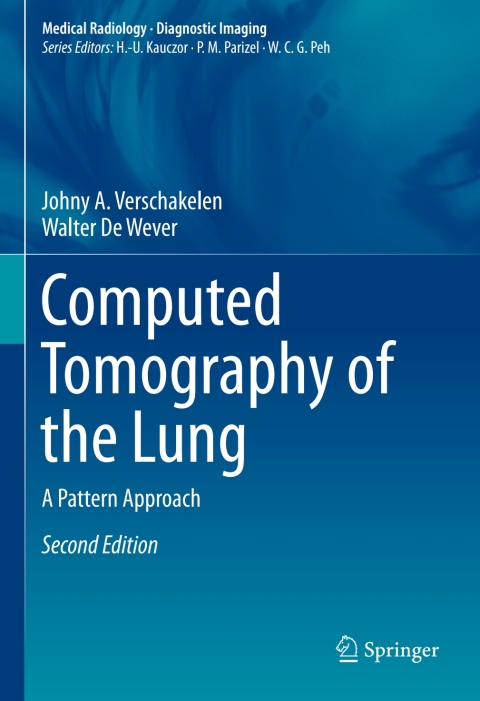 Cover image for book Computed Tomography of the Lung