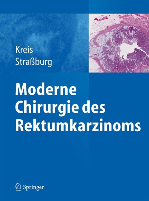 Cover image for book Moderne Chirurgie des Rektumkarzinoms