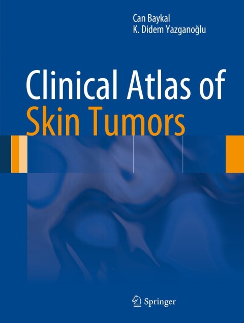 Cover image for book Clinical Atlas of Skin Tumors