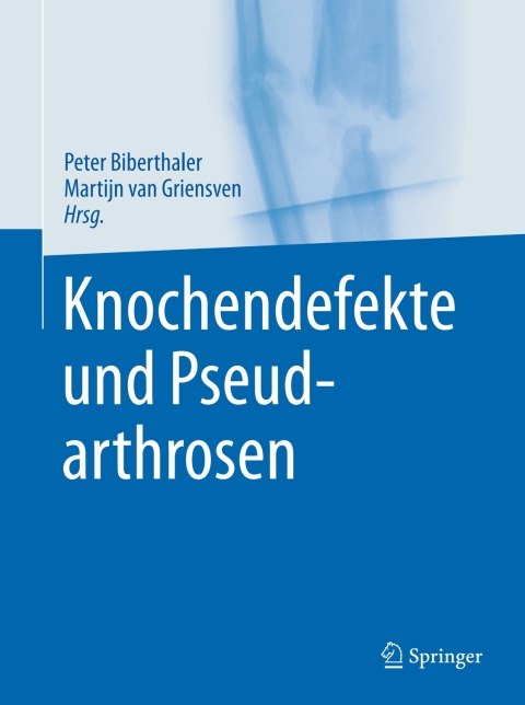 Cover image for book Knochendefekte und Pseudarthrosen