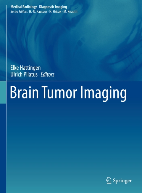 Cover image for book Brain Tumor Imaging