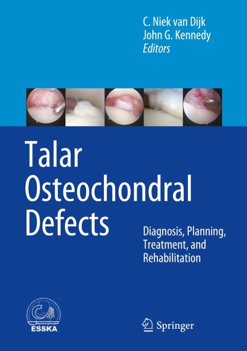 Cover image for book Talar Osteochondral Defects