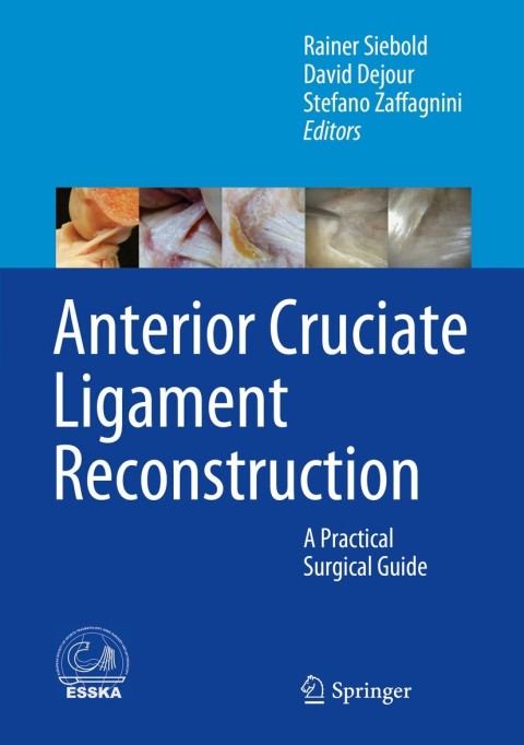 Cover image for book Anterior Cruciate Ligament Reconstruction