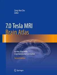 Cover image: 7.0 Tesla MRI Brain Atlas 2nd edition 9783642543975