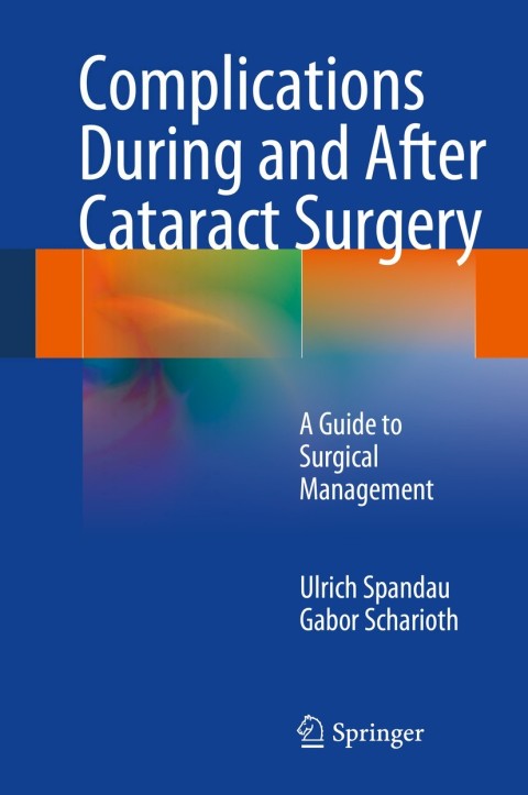 Cover image for book Complications During and After Cataract Surgery