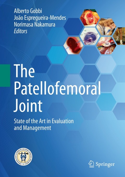 Cover image for book The Patellofemoral Joint