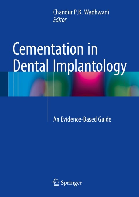 Cover image for book Cementation in Dental Implantology